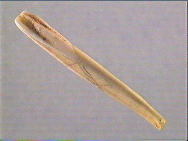 Dent_4