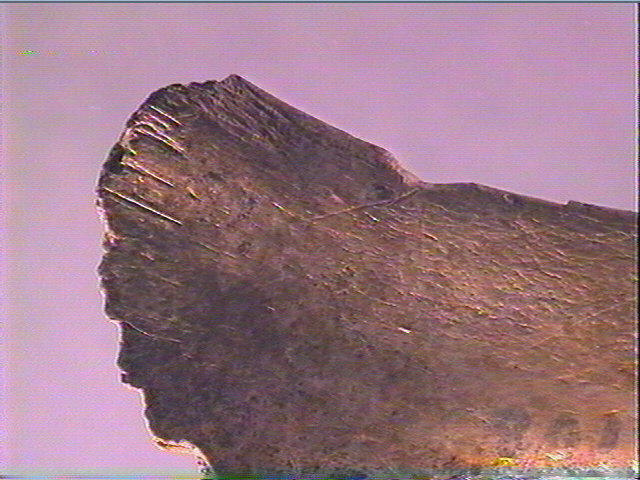 Contour découpé, os hyoïde_2