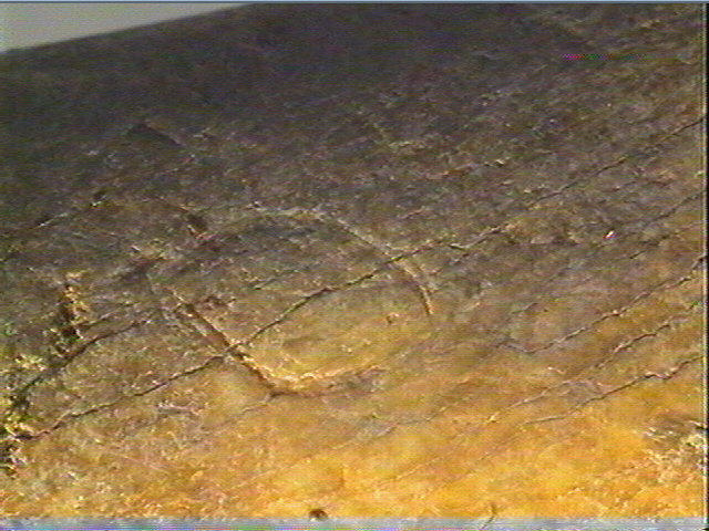 Contour découpé, os hyoïde_4
