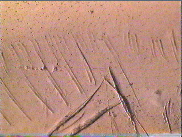 Os indéterminé_5