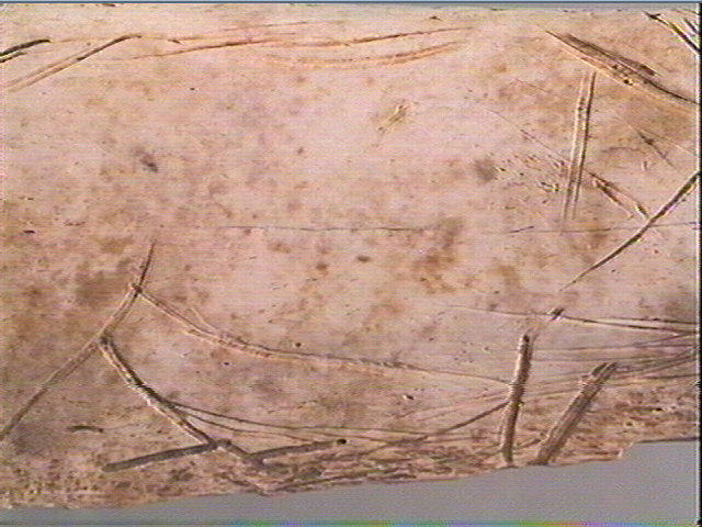 Côte_5