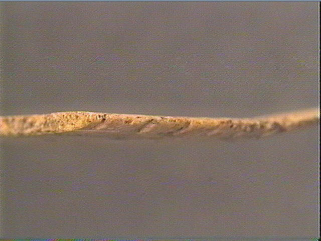 Rondelle, scapula_2