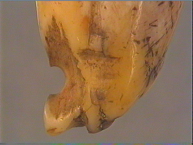 Pendeloque, dent (cachalot)_6