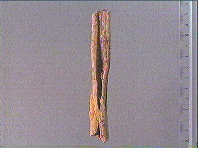 Os indéterminé_3