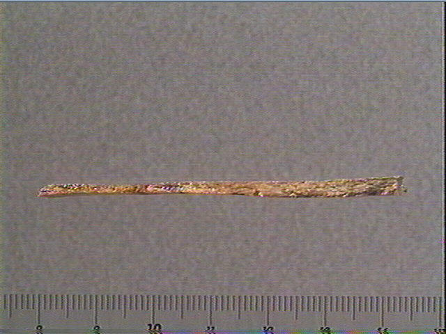 Scapula_1