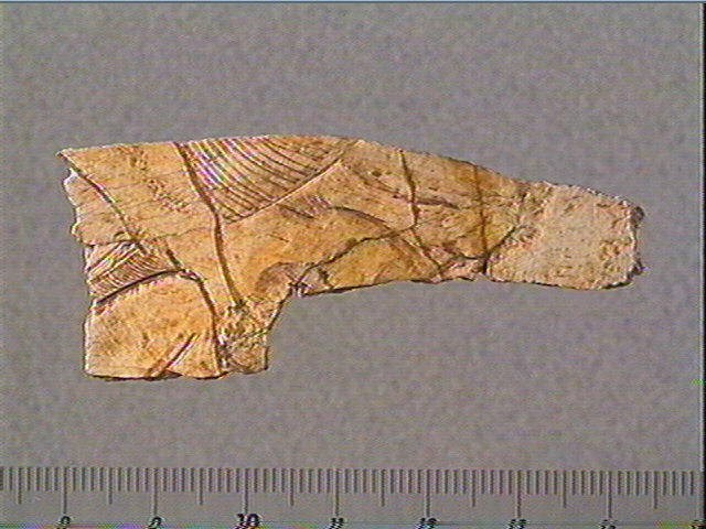 Scapula_2