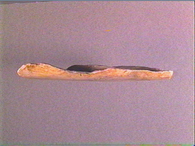 Os indéterminé_1