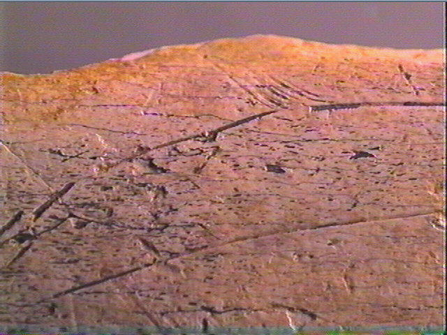 Os indéterminé_5