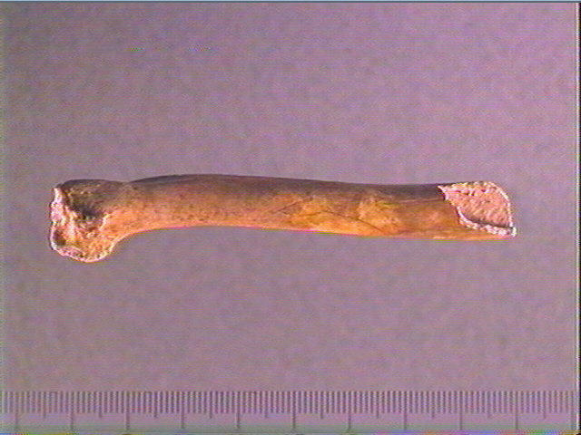 Diaphyse (perforé)_0