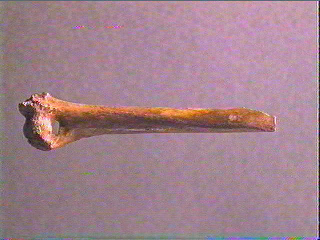 Diaphyse (perforé)_2