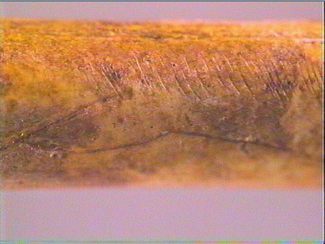 Diaphyse (perforé)_5