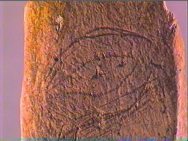 Os indéterminé_4