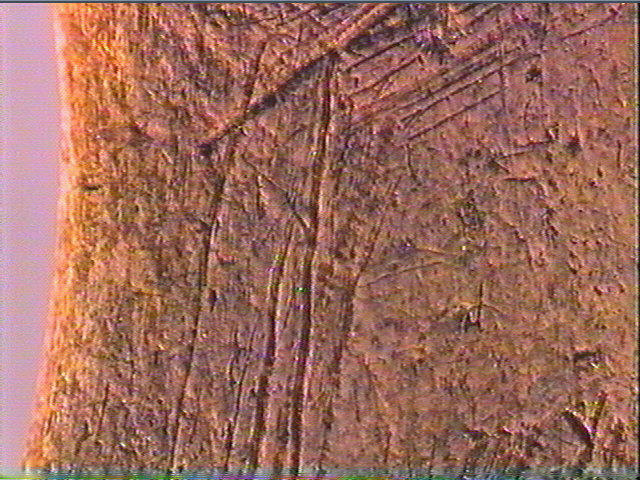 Os indéterminé_6