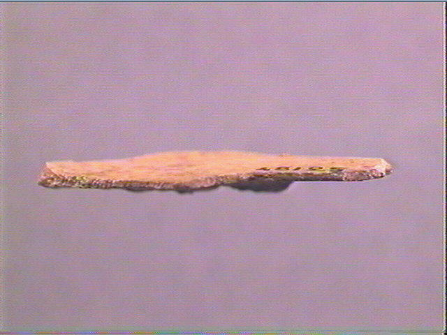 Scapula_1