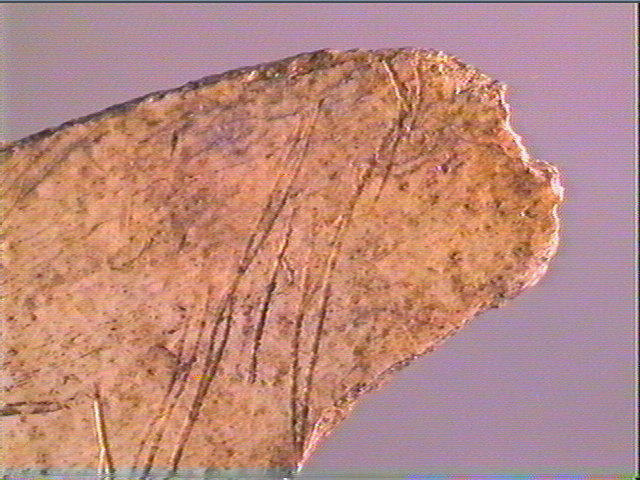 Scapula_4