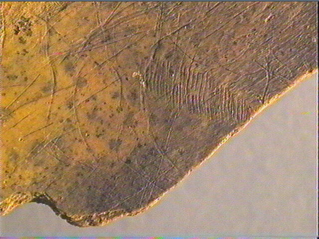 Scapula_2