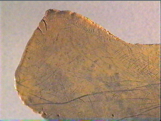 Scapula_3