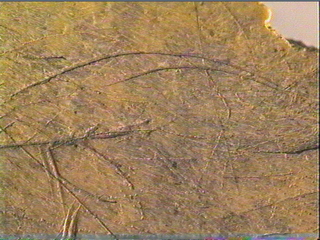 Scapula_5
