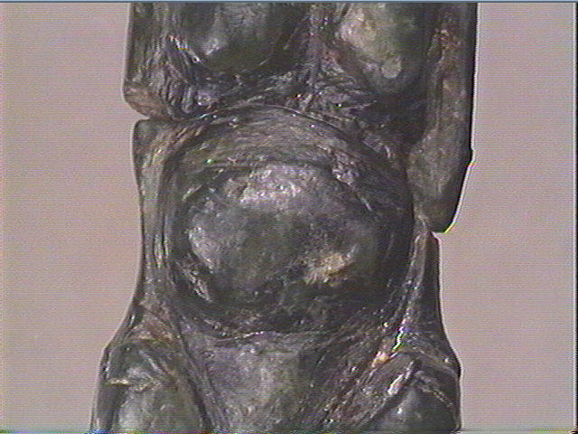 L'hermaphrodite_4