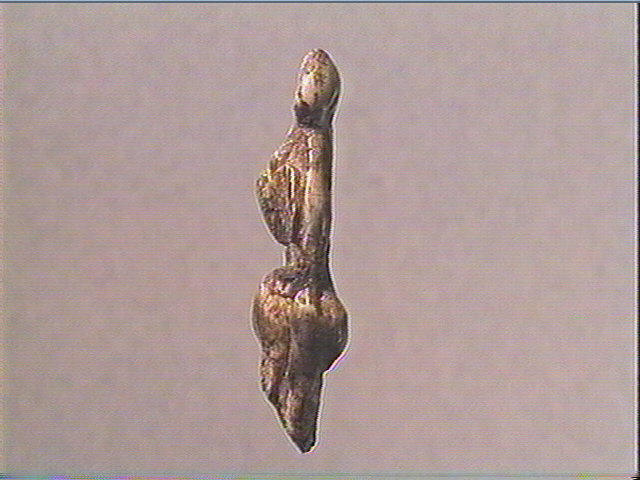 La femme au goître_1