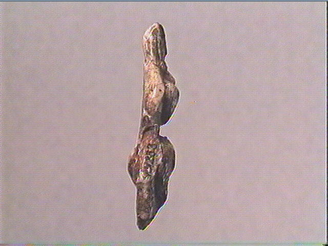 La femme au goître_3