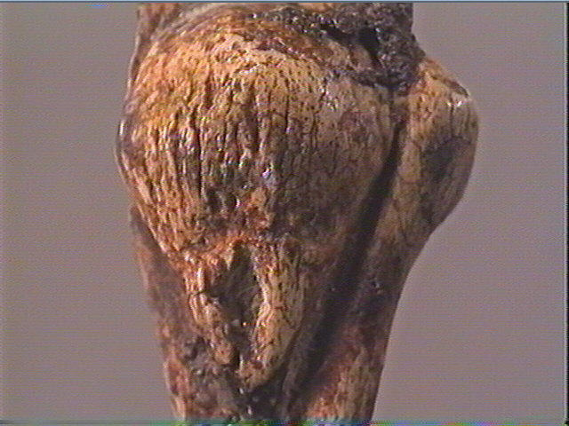 La femme au goître_5