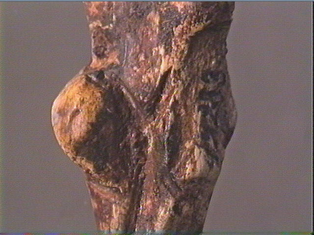 La femme au goître_6