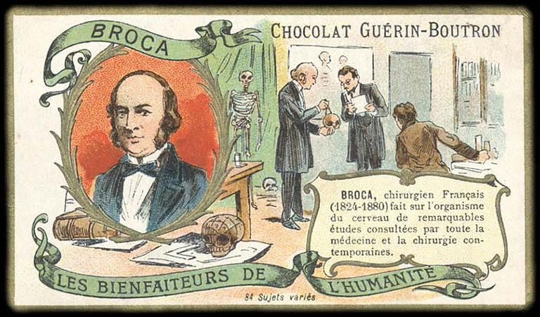 LES BIENFAITEURS DE L'HUMANITÉ ; BROCA (titre inscrit)_0