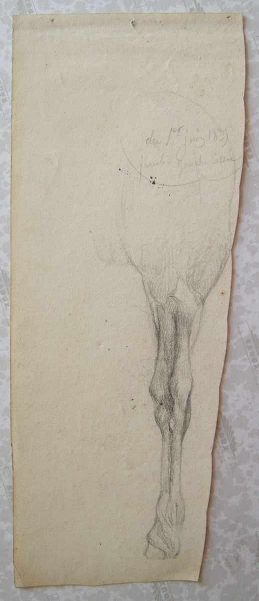 Jambe gauche cassée. (titre inscrit), Brivet, 1835 1er juin