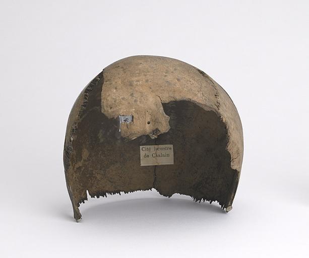Calotte crânienne (humain, fragment)_0