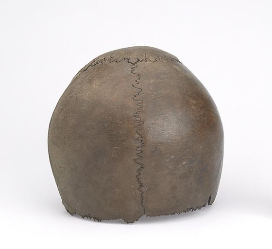 Calotte crânienne (humain, fragment)_2