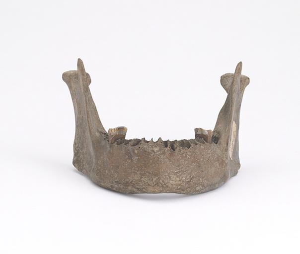 Mandibule (humain)_0