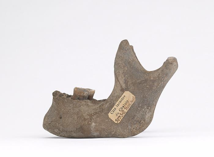Mandibule (humain)_1