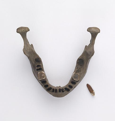 Mandibule (humain)_2