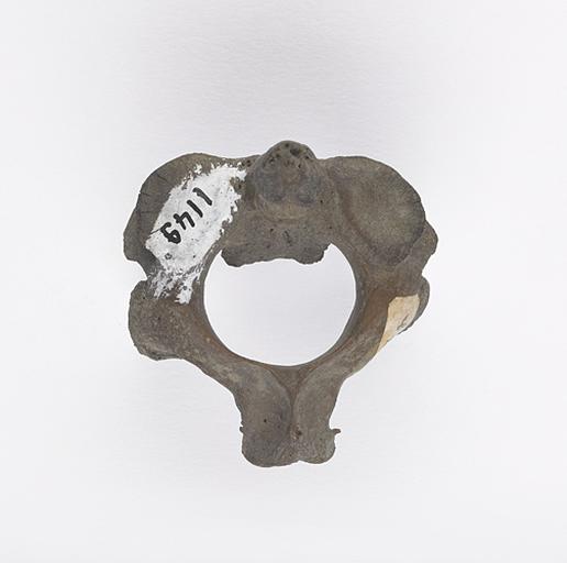 Vertèbre (humain)_0