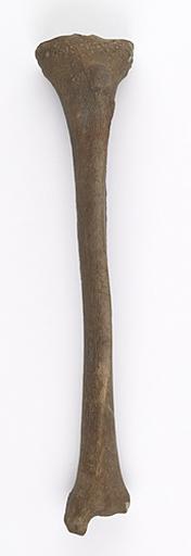 Tibia (humain)_0