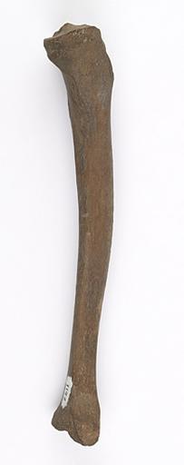 Tibia (humain)_1