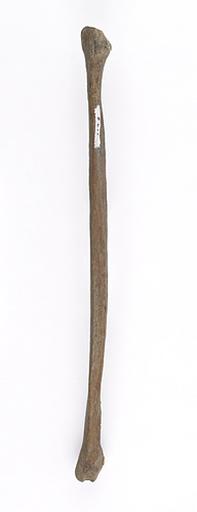 Fibula (humain)_0