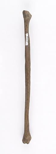 Fibula (humain)_1