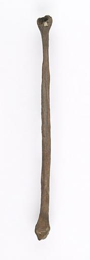 Fibula (humain)_0