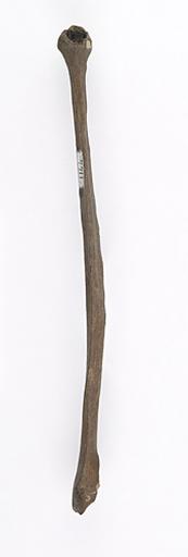 Fibula (humain)_1