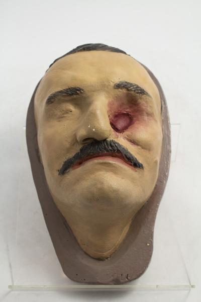 Moulage de gueule cassée_2