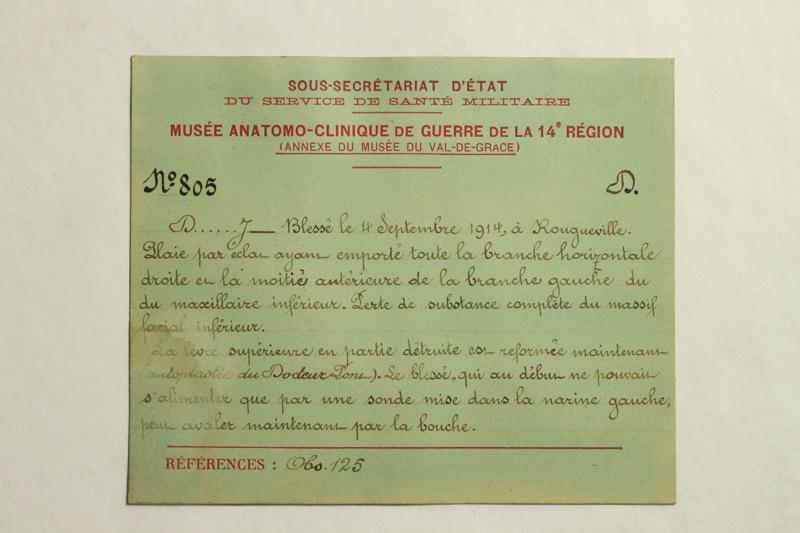 Gueules Cassées (titre factice), Raphaël Désiré Freida, 1918