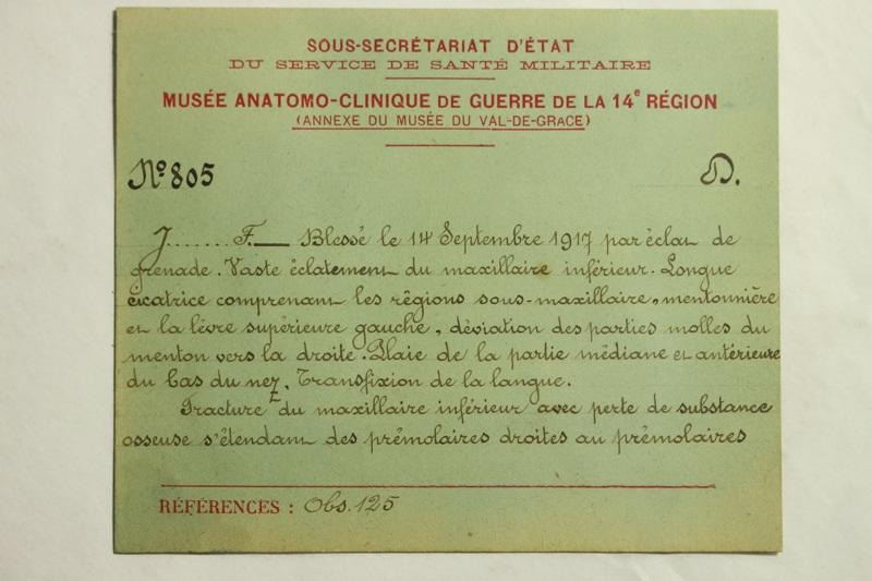 Gueules Cassées (titre factice), Raphaël Désiré Freida, 1917
