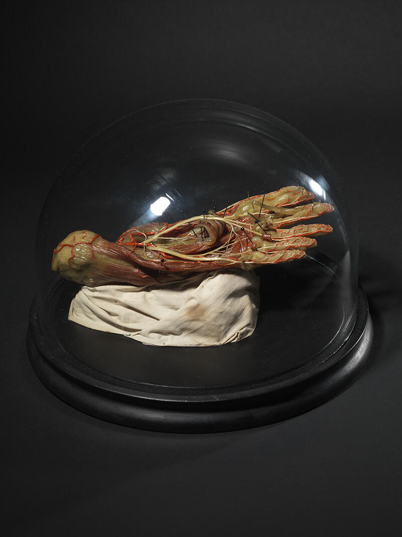 Muscles et tendons du pied_0