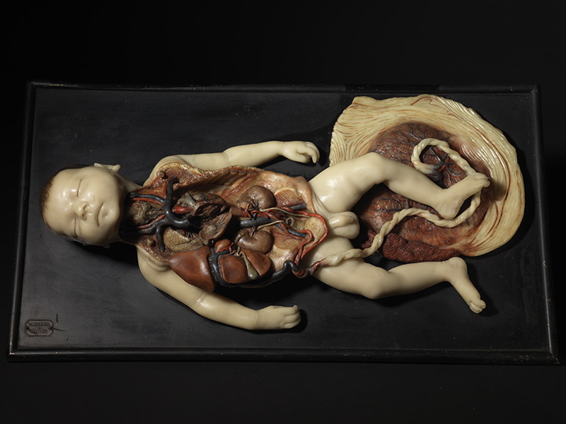 Foetus à terme_0
