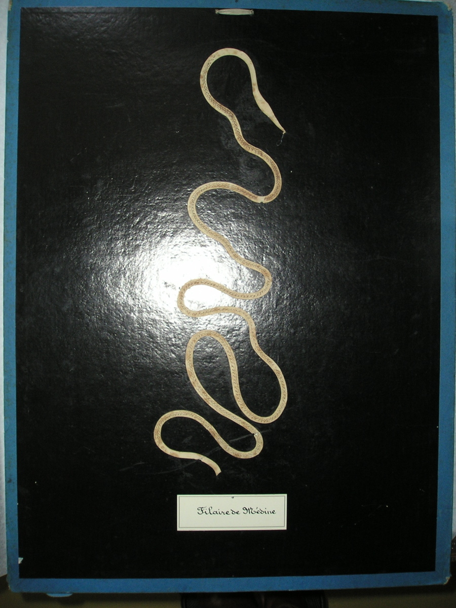 Filaire de Médine_0