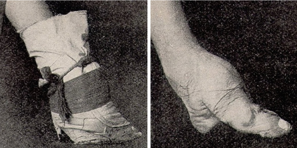 Chaussure_1