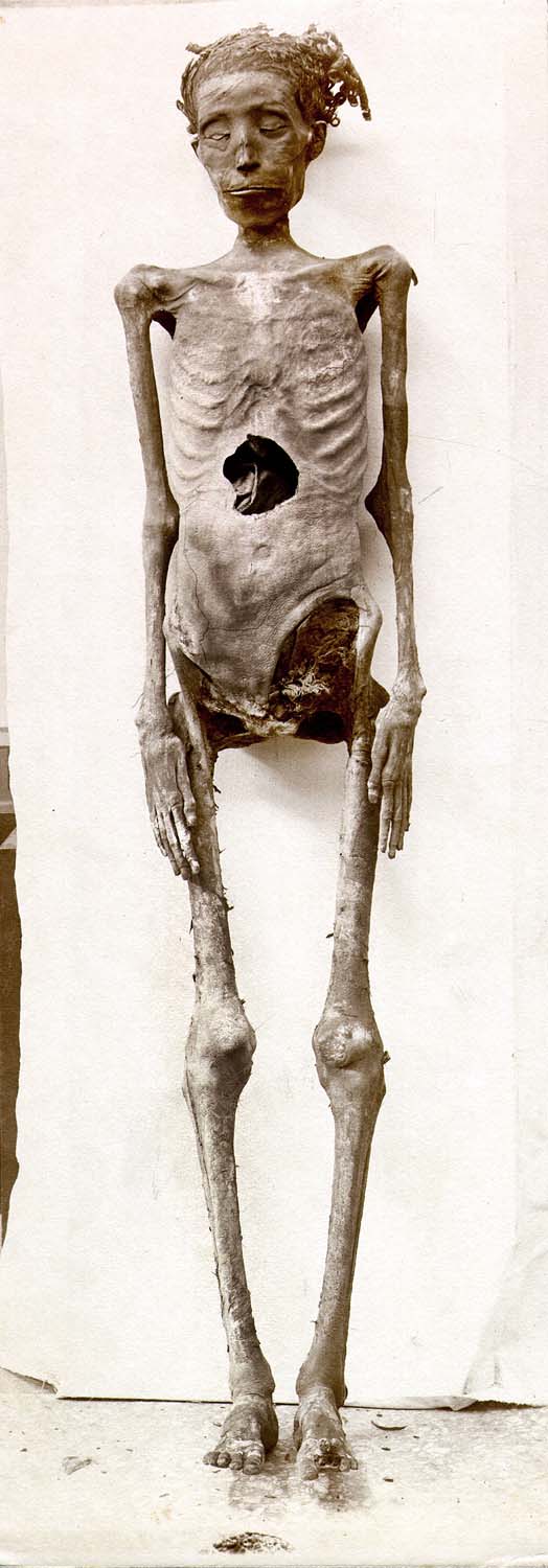 Momie de la femme inconnue « D », trouvée dans le sarcophage de Sethnakht : ensemble, vu de face