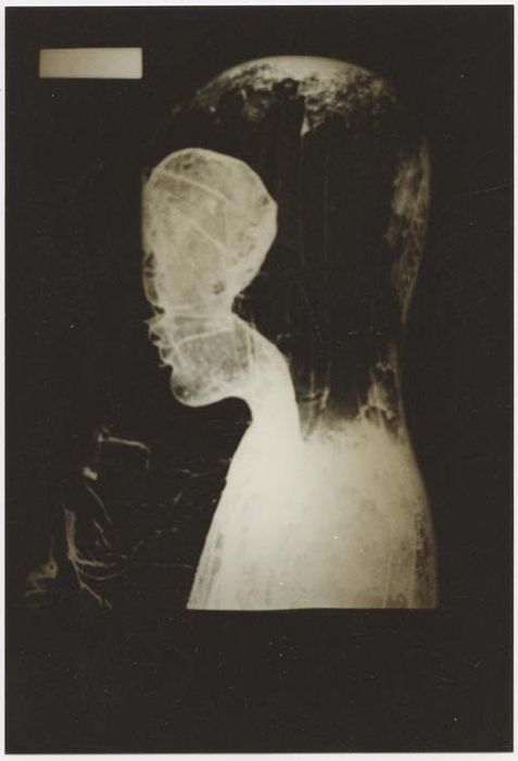 statue : Vierge à l’enfant (radiographie)